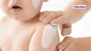 5 Manfaat Baby Cream yang Jarang Diketahui, Harus Tahu!